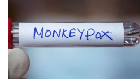 Mpox ਵਾਇਰਸ ਨੇ ਵਧਾਈ ਚਿੰਤਾ, WHO ਨੇ ਵਿਸ਼ਵਵਿਆਪੀ ਸਿਹਤ ਐਮਰਜੈਂਸੀ ਦਾ