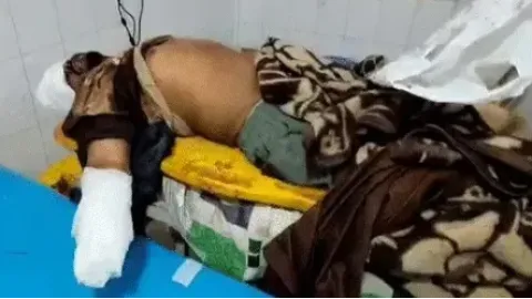 ਘਰ ਵਿੱਚ ਵੜ ਕੇ ਨੌਜਵਾਨ ਦਾ ਹੱਥ ਕੱਟ ਕੇ ਕੀਤਾ ਵੱਖ